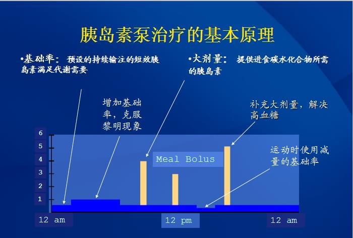 胰岛素泵工作原理