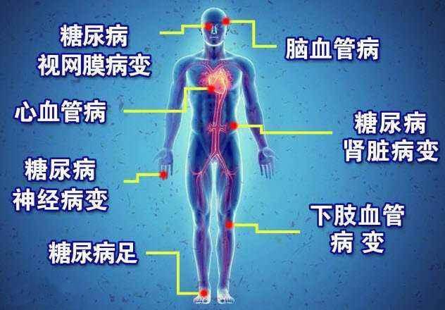 糖尿病及并发症