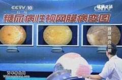 什么是糖尿病，有哪些危害？