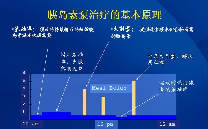 胰岛素泵，胰岛素泵原理，胰岛素泵怎么样