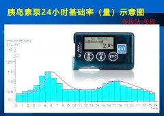 胰岛素泵24小时基础率（量）概述及调节方法