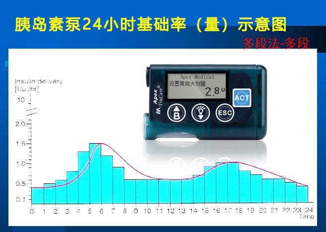 胰岛素泵基础率