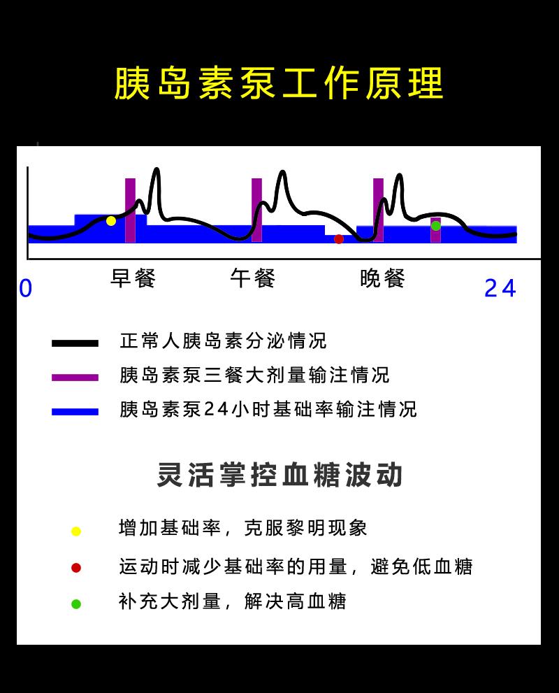 胰岛素泵的工作原理